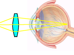 GCSE P3 Physics - The Human Eye and Lenses | Teaching Resources