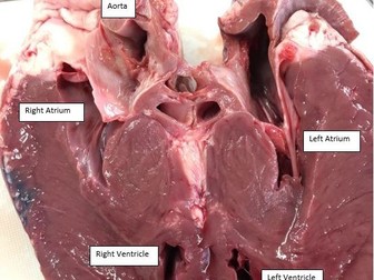 Heart dissection