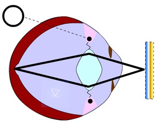 Accommodation of the eye