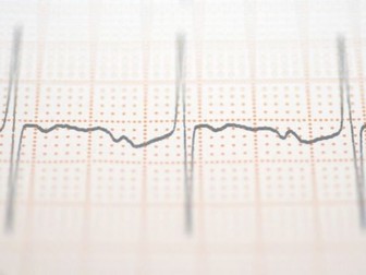 Edexcel A-Level PE: 1.2.1–1.2.9 Cardiovascular & Cardiorespiratory Pack