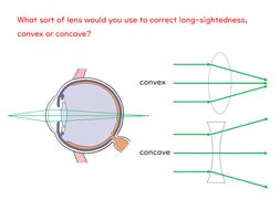 The Eye Slides and Worksheet (GCSE Biology AQA) | Teaching Resources