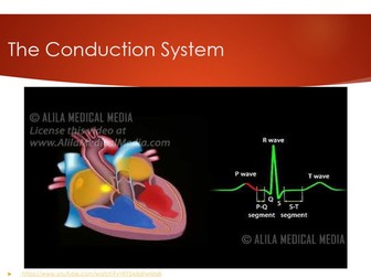 Conduction System of the Heart Lesson - A-Level