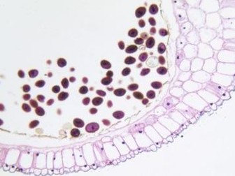 U5 B3d Osmoregulation, ADH & Water absorption in collecting duct.