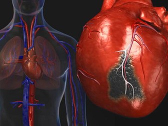 Cardiovascular Disease CVD Risk Factors