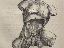 Medicine in the Renaissance - Research grids