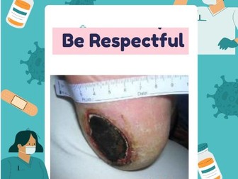 Pressure Ulcer Injury Match Up Activity