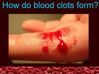 How Do Blood Clots Form?