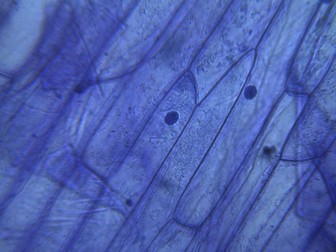 Onion Cells
