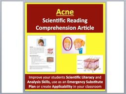 Acne - Science Reading Article - Grades 5-7