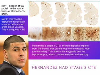Aaron Hernandez - CTE Brain Injury - Murder Defenses - Criminal Law - 70 Slides
