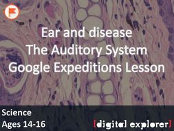 Ear and disease #GoogleExpeditions Lesson