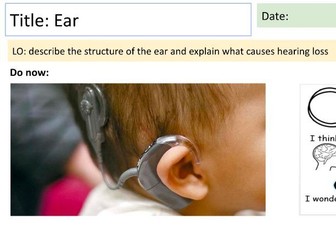 Ear structure and causes of hearing damage